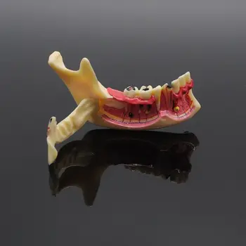 Модель зубов Модель эндодонтического лечения зубов Анатомия десен Модель для изучения зубов